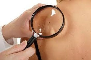 Foto Visita Dermatologica con mappatura nei in epiluminescenza